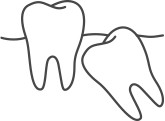 line drawing showing a molar in need of extraction